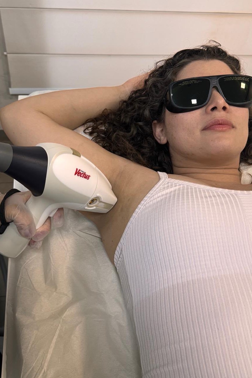 Sessão de depilação a laser com o Vectus na Milele Clinic Dourados