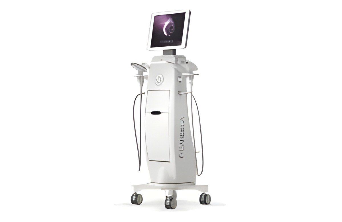 Tecnologia E-Matrix na Milele Laser